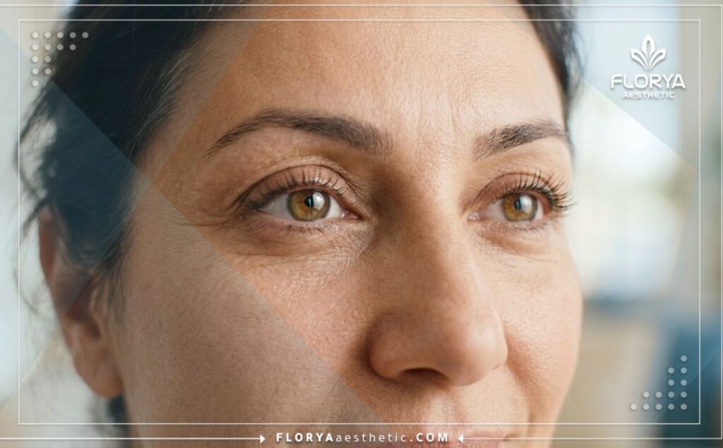 Perfect aesthetic and healthy result of an eye procedure