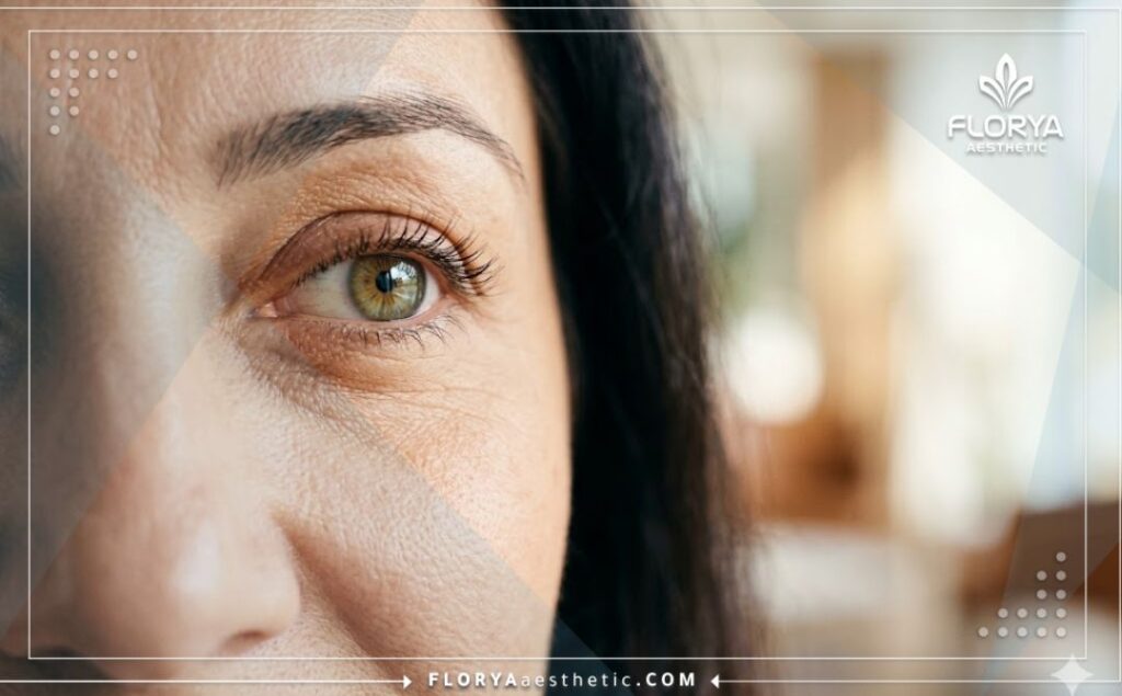 Résultat parfait et vue claire pour les yeux