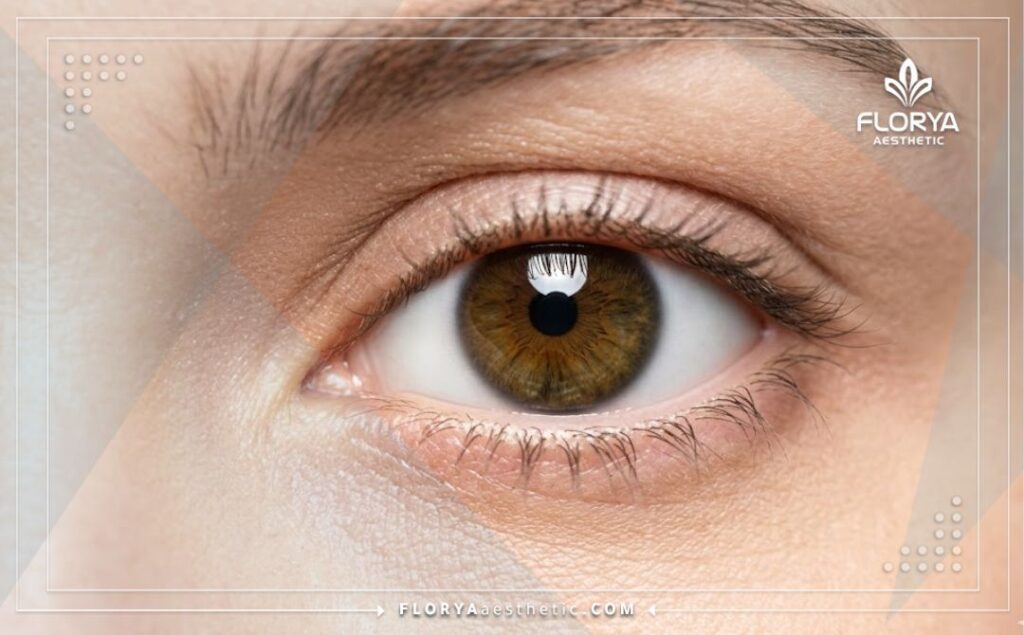 Close-up showing the flawless and healthy result of successful retina treatment.