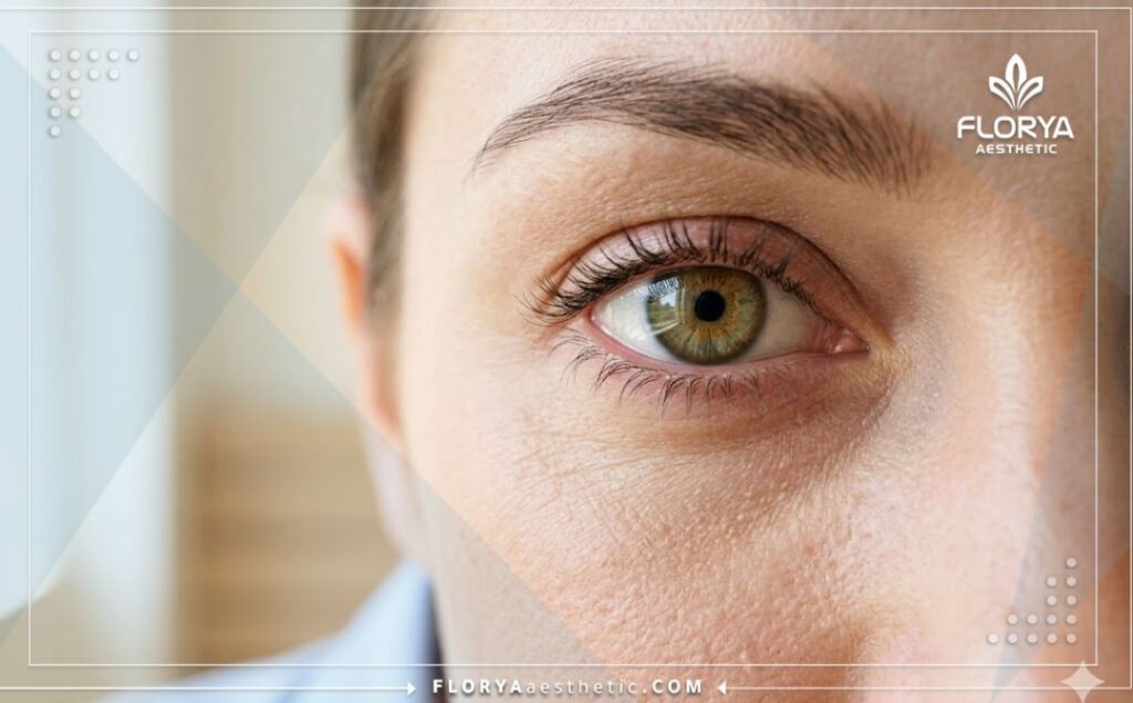 Gros plan mettant en valeur le résultat esthétique parfait et naturel de la prothèse.