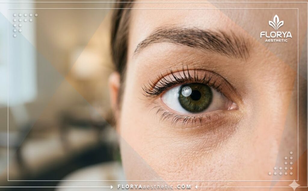 Primer plano de un ojo brillante y sano que muestra el resultado perfecto del LASIK.