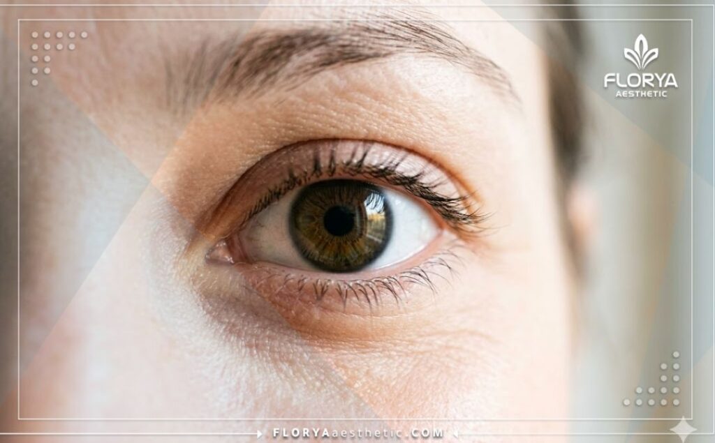 عين صحية ورؤية واضحة تبرز النتيجة المثالية بعد تصحيح النظر