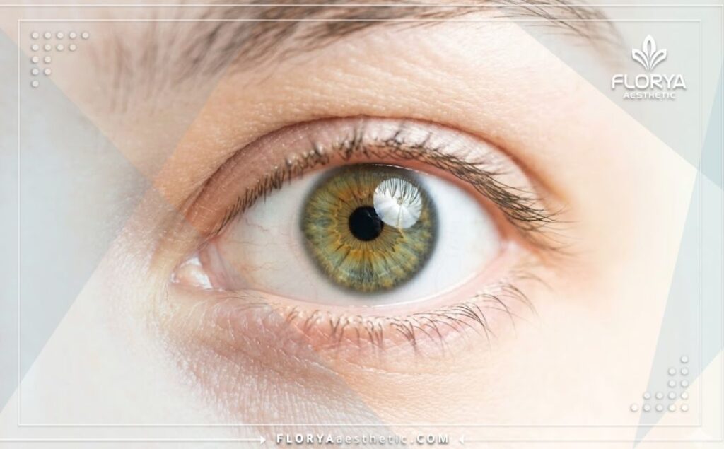 Close-up of a perfect, clear eye reflecting successful laser treatment