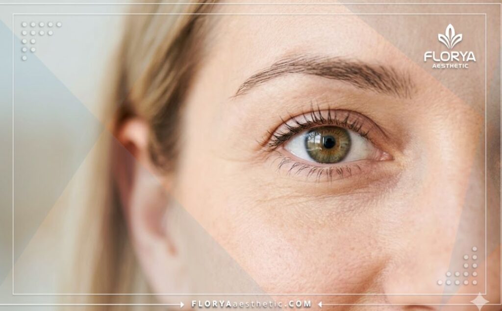 Close-up of a perfect, clear eye showcasing the beautiful outcome of a successful cornea transplant.