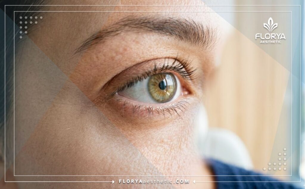 Крупный план здорового и ясного глаза после успешного восстановления зрения