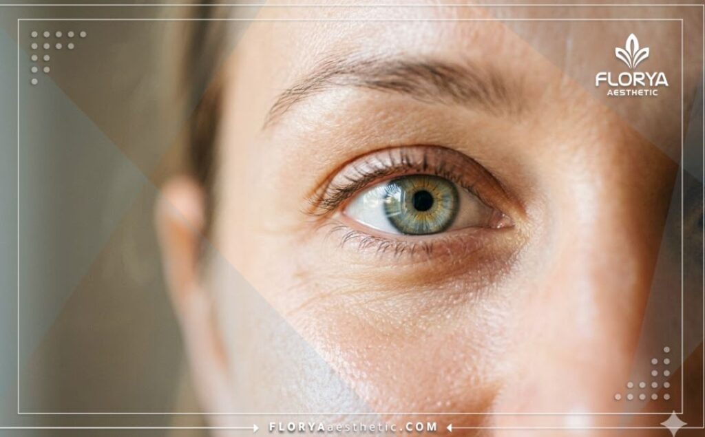 Идеальный результат здорового увлажненного глаза после терапии