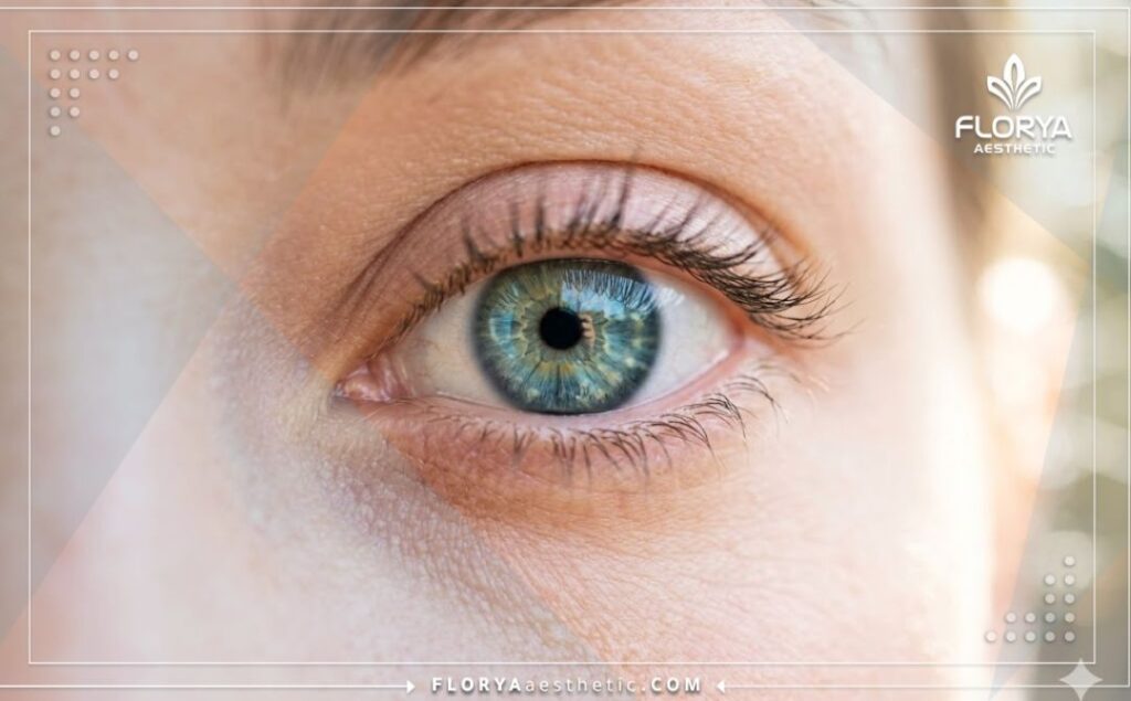 Flawless and stunning natural result of an eye color transformation.