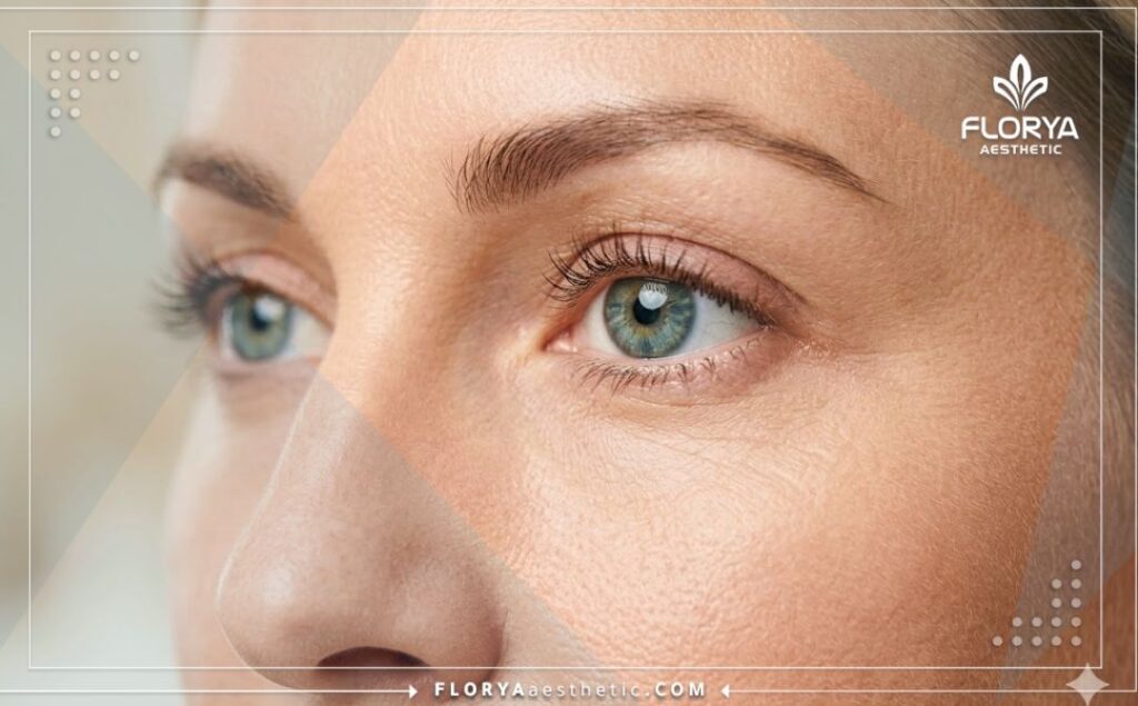 Cinematic close-up showcasing a beautiful and flawless eye outcome