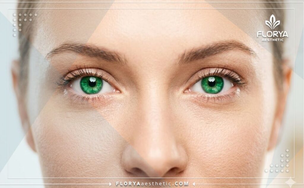 Flawless and highly detailed aesthetic result of eye color change