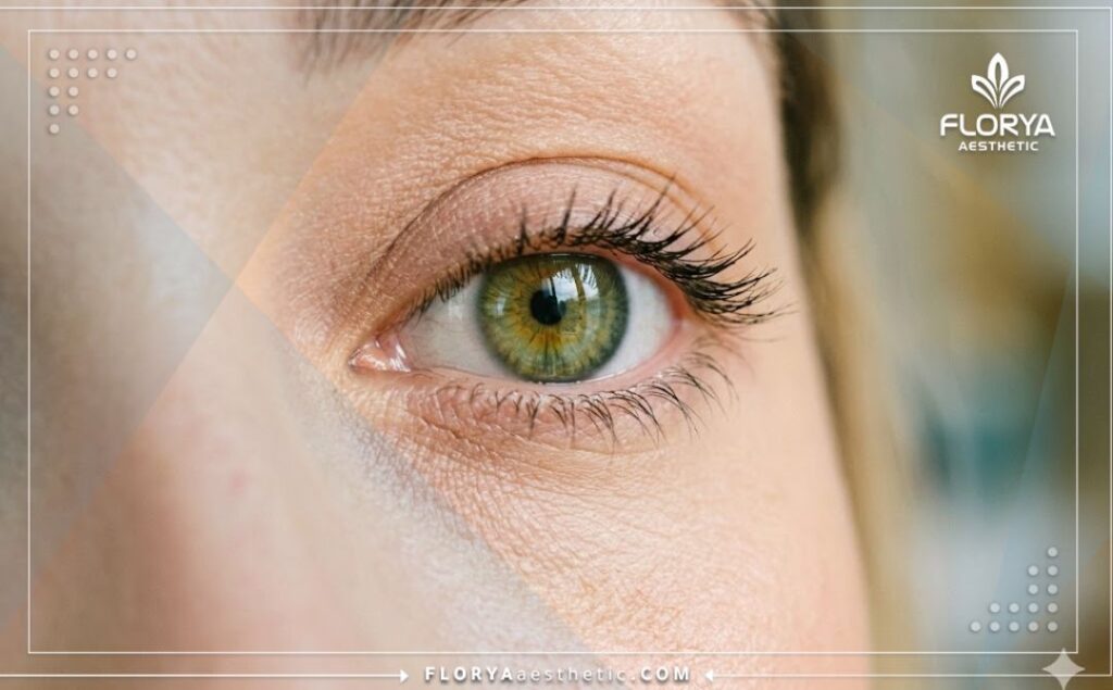 نتيجة مثالية وجميلة لعملية تغيير لون العين بلون طبيعي وجذاب