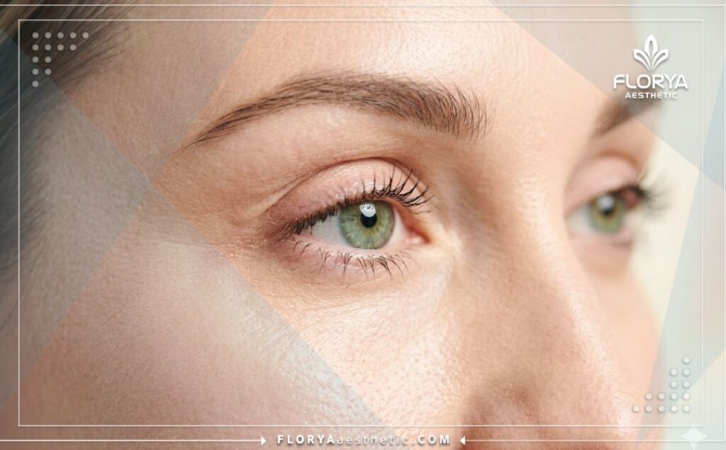نتيجة جمالية مثالية وطبيعية بعد إجراء جراحة العيون في العيادات المتخصصة.
