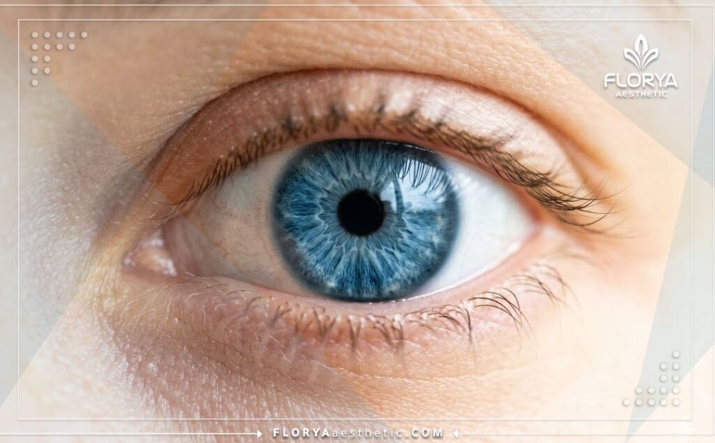 Close-up of a stunning, natural-looking permanent eye color result.