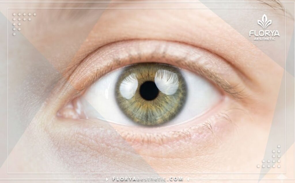 Œil clair et parfait montrant le résultat réussi de l'intervention