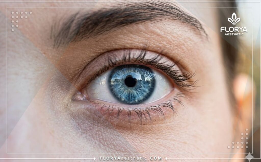 لقطة مقربة تبرز النتيجة المثالية واللون الجذاب بعد العملية.