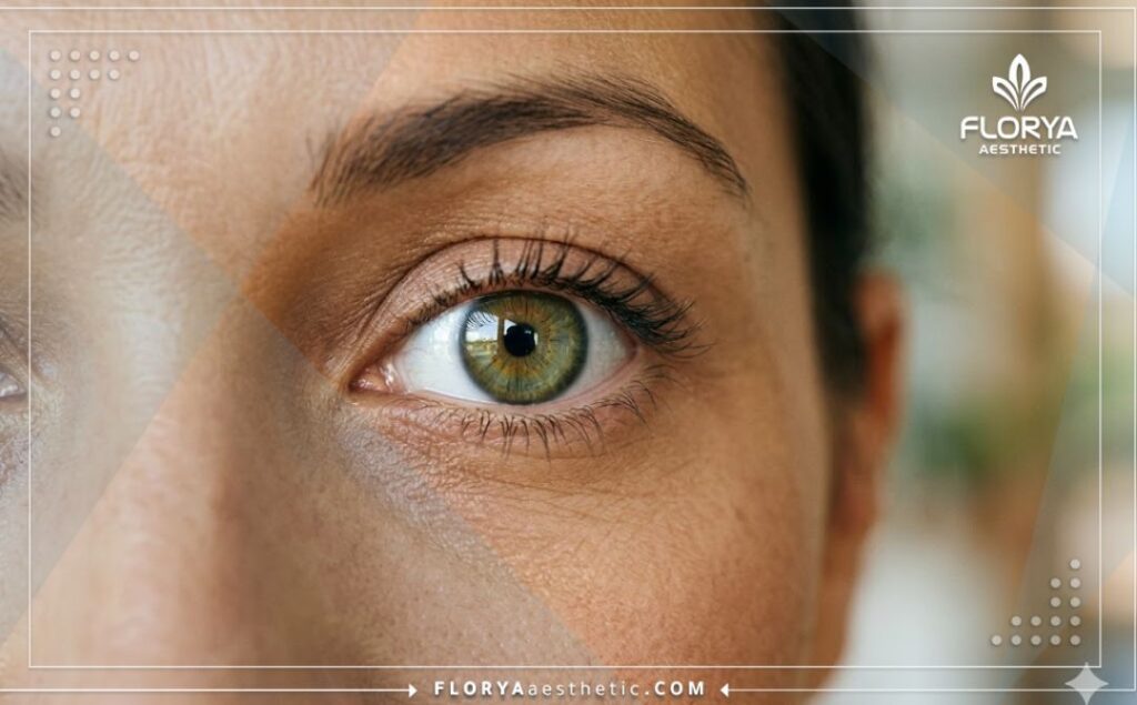 Крупный план здорового и ясного глаза после успешного вмешательства.