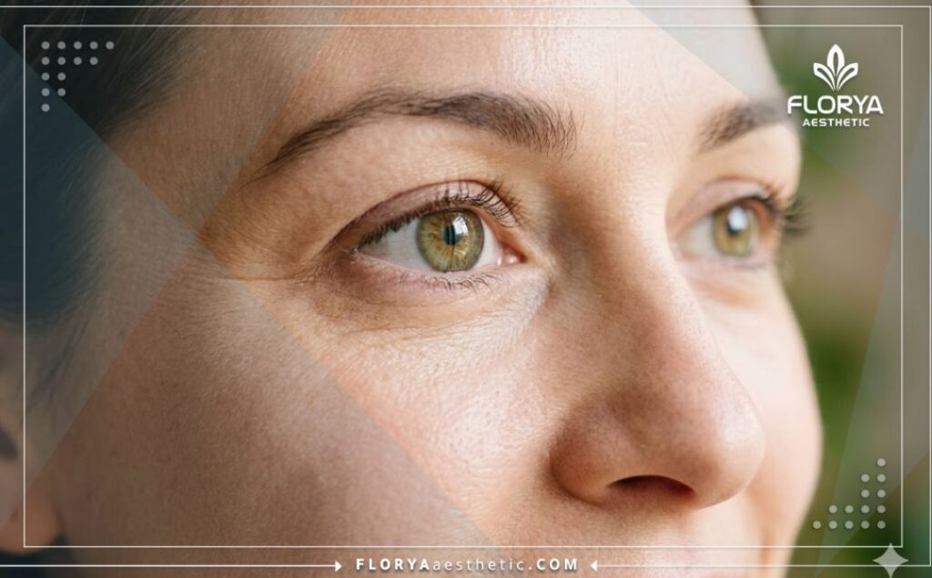 نتيجة مثالية وعين صحية بعد نجاح العلاج