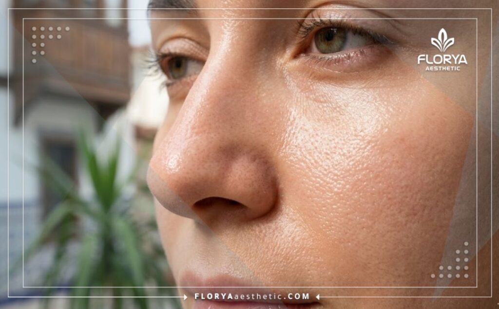 Cinematic close-up of flawless glowing skin highlighting a perfect treatment result