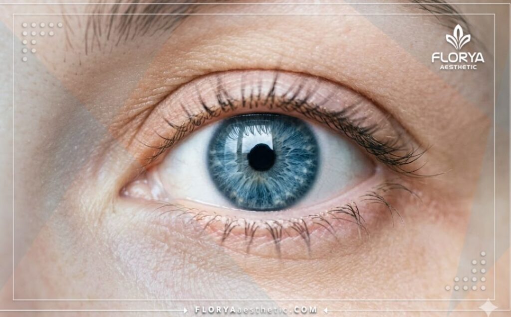 نتيجة مثالية وجمالية ناجحة بعد إجراء عملية القزحية بعيون جذابة
