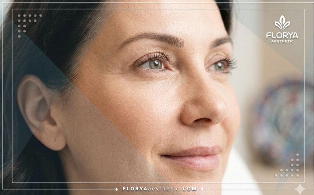 نتائج مثالية وبشرة مشدودة وخالية من التجاعيد بعد العلاج التجميلي