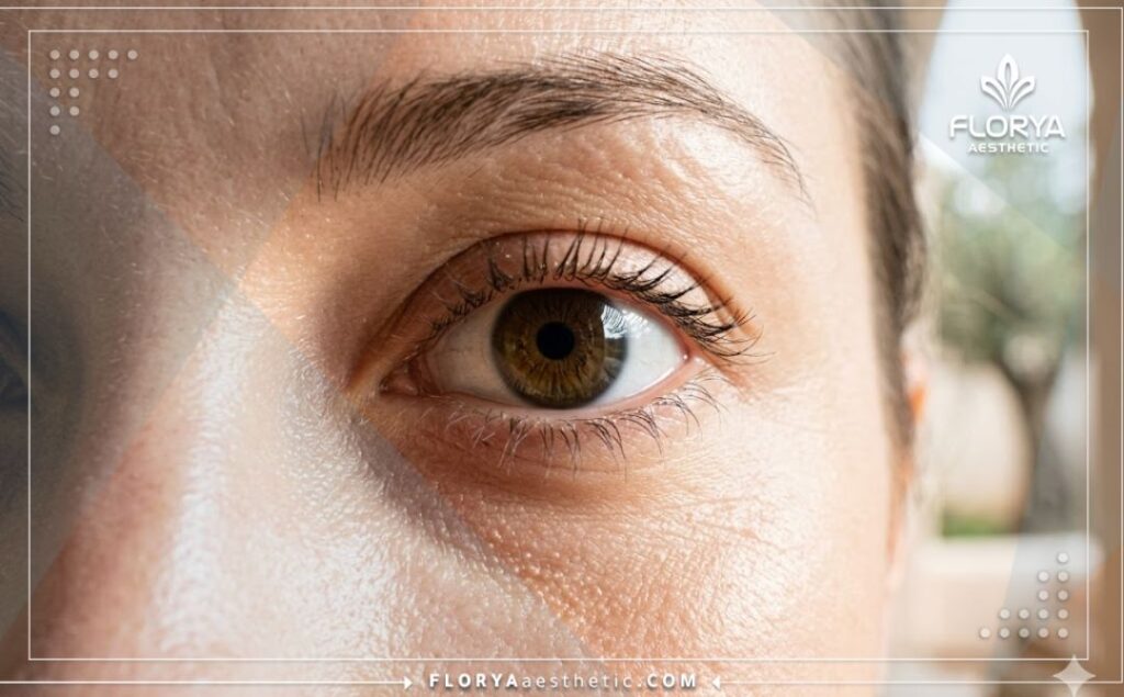 نتيجة مثالية ورؤية واضحة بعد نجاح علاج العين.