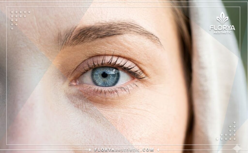 Ojo con aspecto perfecto tras una exitosa corrección visual con láser