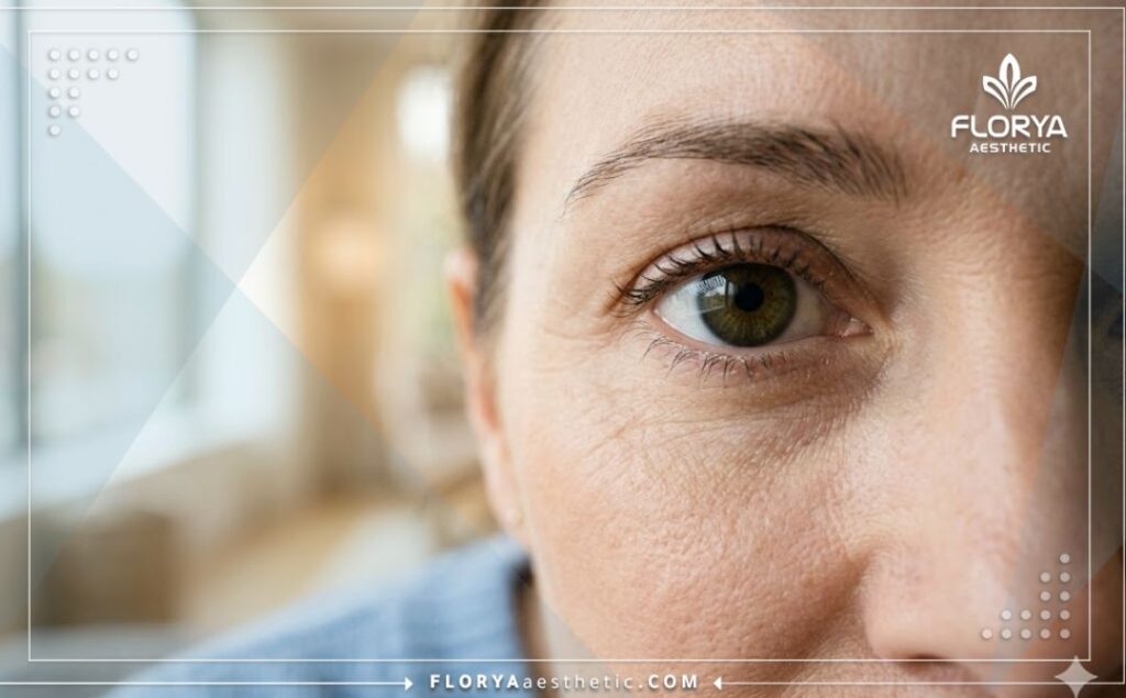 Gros plan sur un œil en parfaite santé après le succès de la procédure