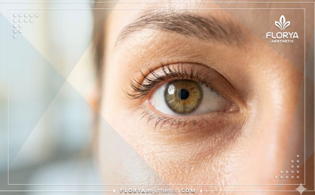 Primer plano cinematográfico de un ojo sano tras una exitosa intervención oftalmológica.