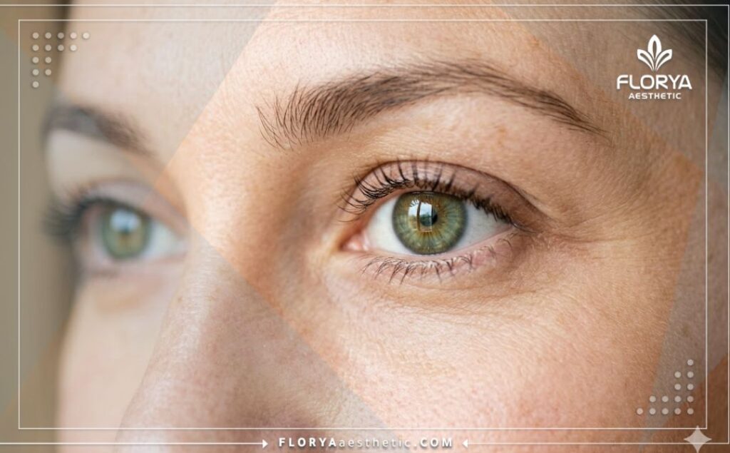 Gros plan sur des yeux parfaits et sains après une intervention réussie.