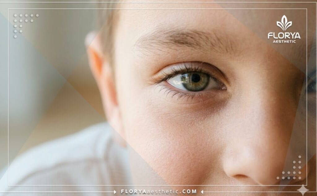 Perfect, natural, and symmetrical result of the corrected eyelid.