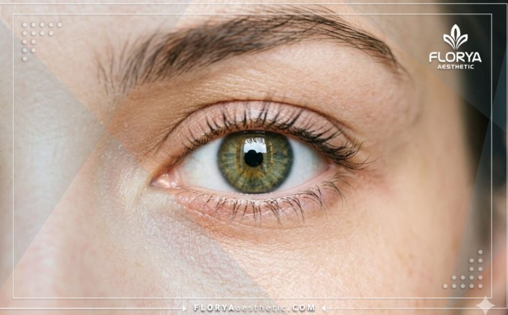 Close-up of perfectly healthy eyes showing a successful medical outcome
