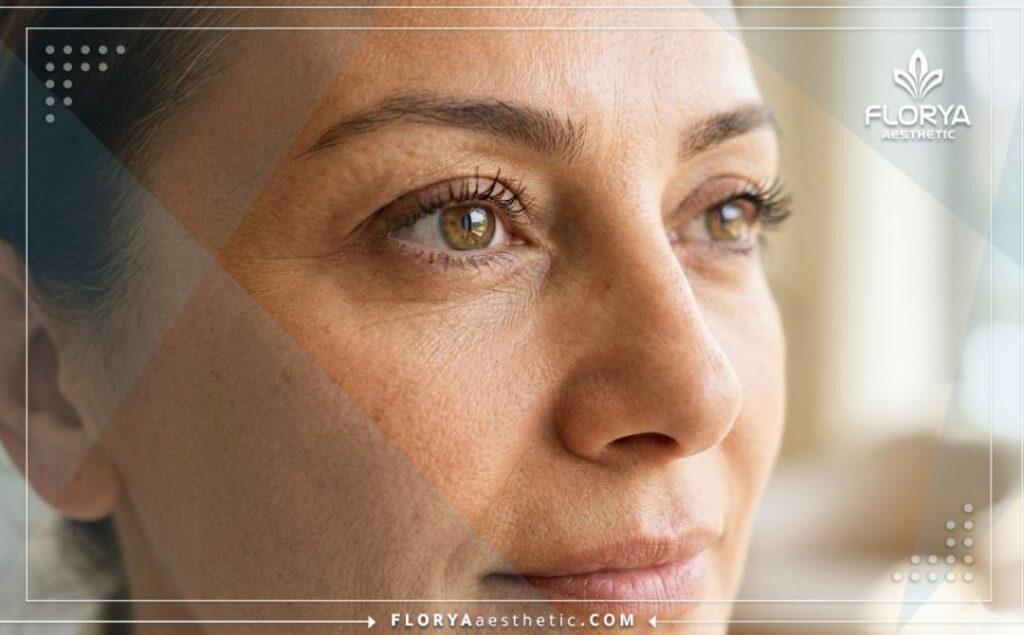 Close-up of a clear, healthy eye reflecting the perfect result of surgery