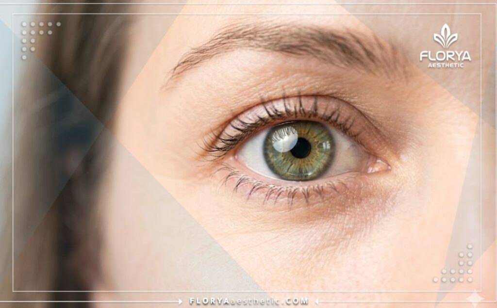 Close-up of a perfect, clear eye showing successful lens replacement results