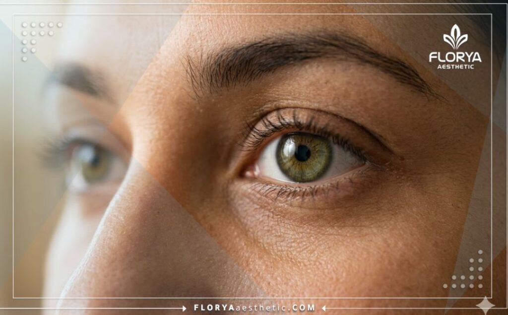 نتيجة مثالية وعين سليمة تماماً بعد الجراحة الناجحة.