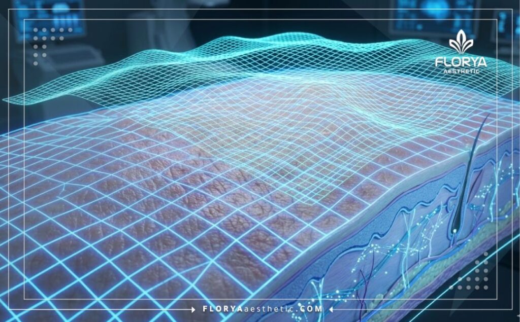 Escáner 3D macro de la superficie de la piel con cuadrícula láser para visualización de alta tecnología.