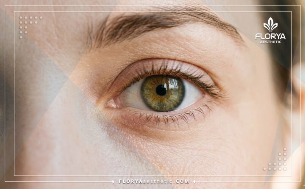 Œil clair et en pleine santé montrant le résultat parfait.