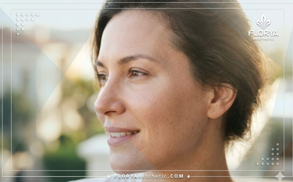 Идеальный и естественный результат после введения филлеров в виски крупным планом.