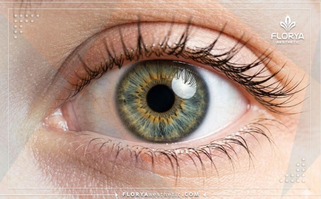 Gros plan d'un œil sain et parfait montrant l'excellent résultat de l'intervention.