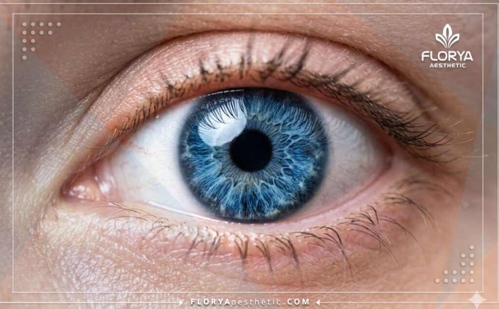 Close-up showing the flawless and natural aesthetic result of an iris color procedure