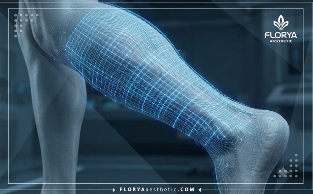High-tech 3D surface scan and laser grid visualization of the calf and ankle anatomical area