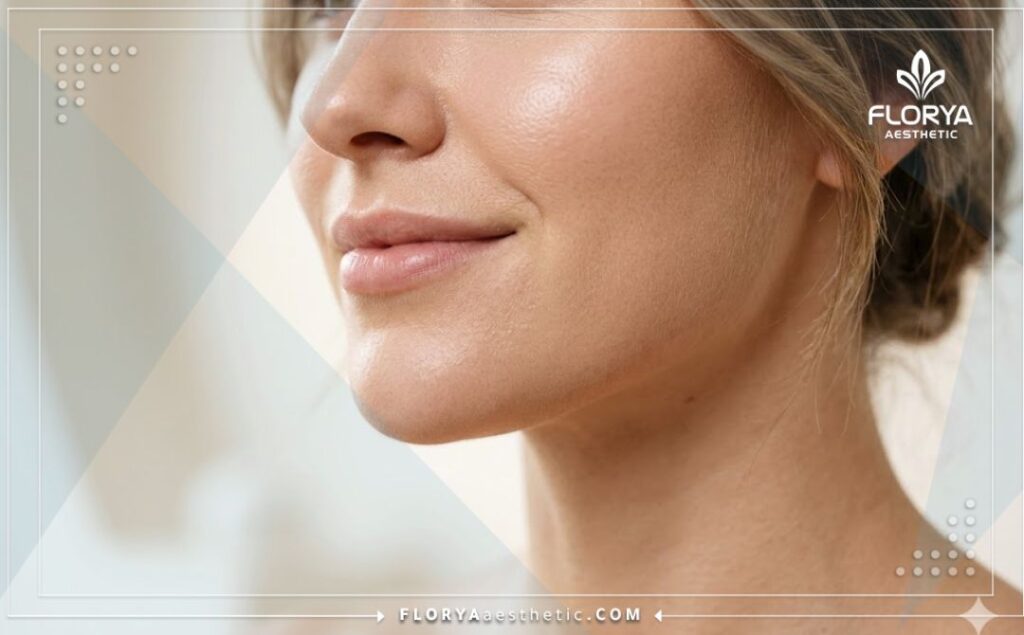 Close-up showing the flawless and aesthetic result of a chin filler treatment.