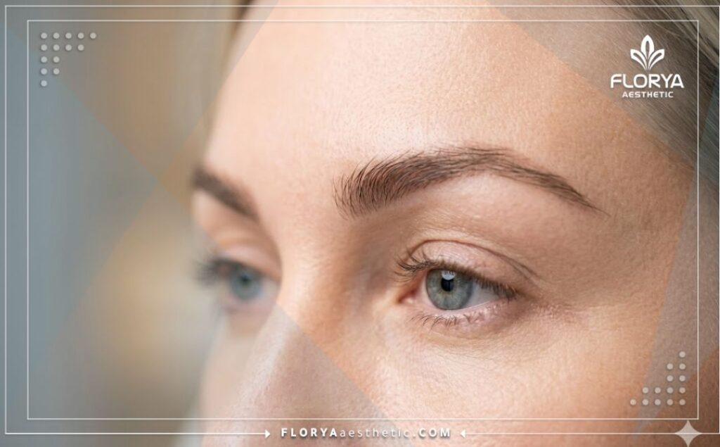 النتيجة المثالية والطبيعية بعد إجراء التجميل لمنطقة الحاجب