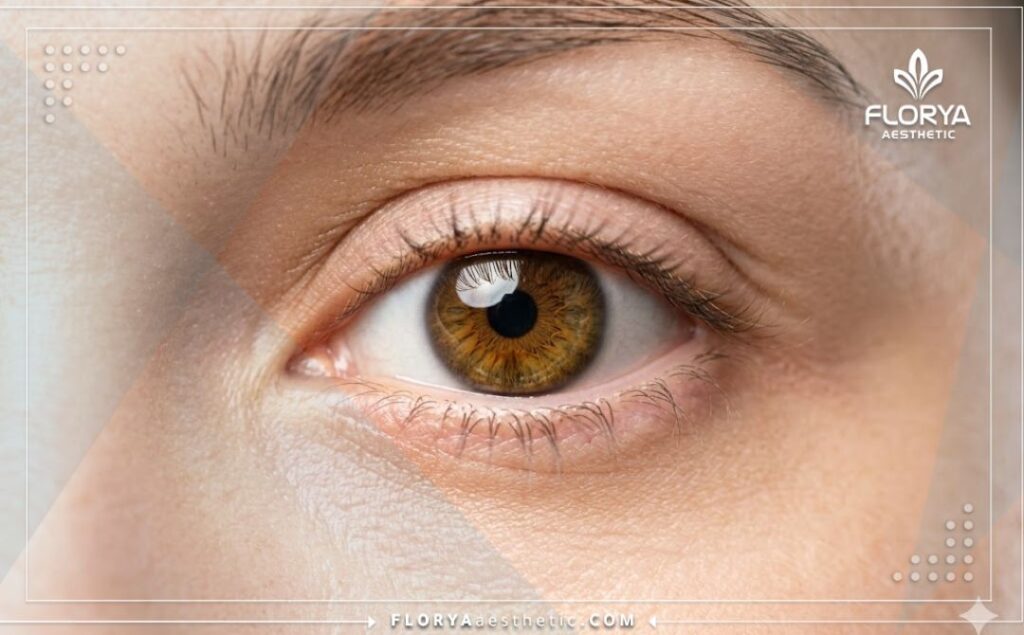 Perfect and natural cosmetic result of a successfully reconstructed eye cornea