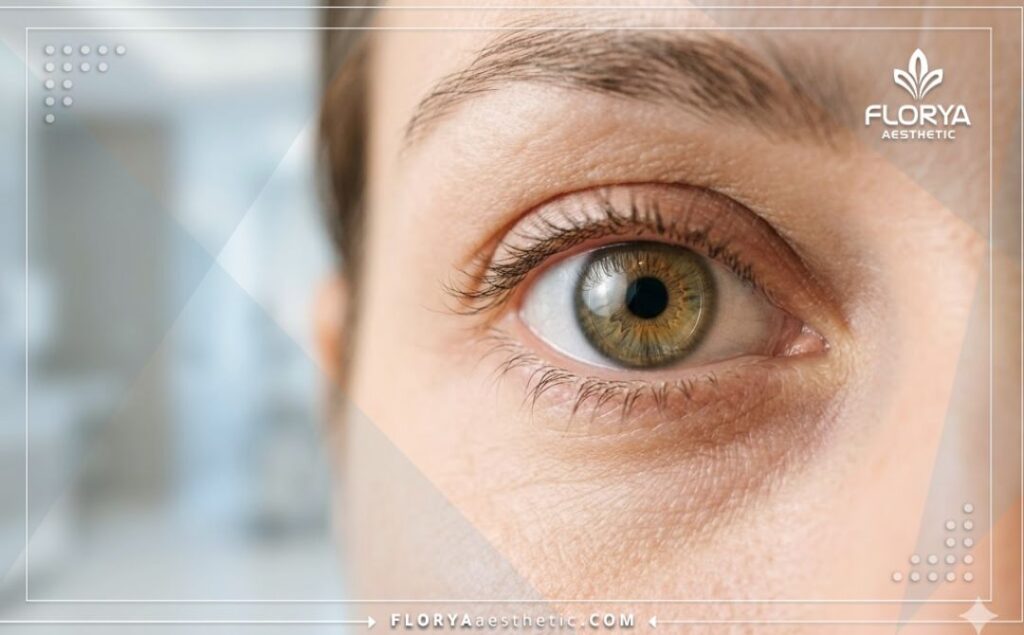 Perfect and clear vision result showcasing a healthy aesthetic eye