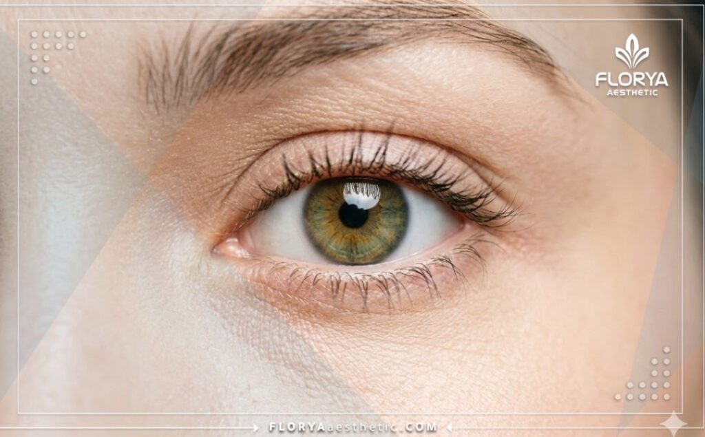 Résultat esthétique parfait d'un changement de couleur des yeux.