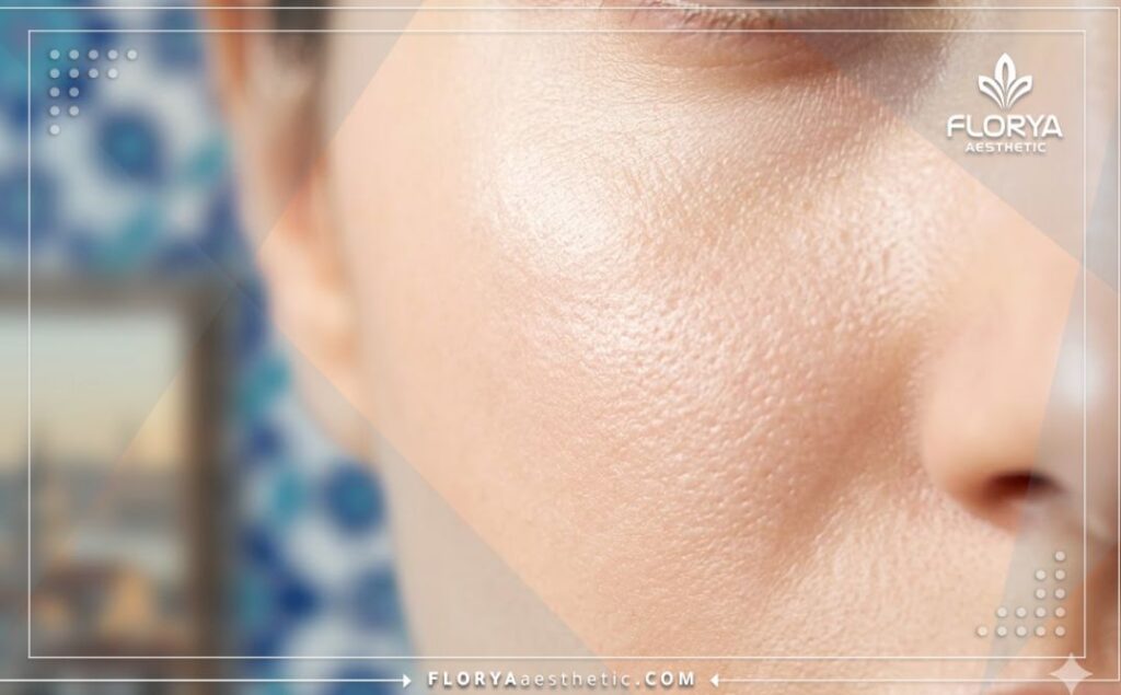 Macro close-up showing the perfect, flawless skin result achieved after advanced laser therapy.