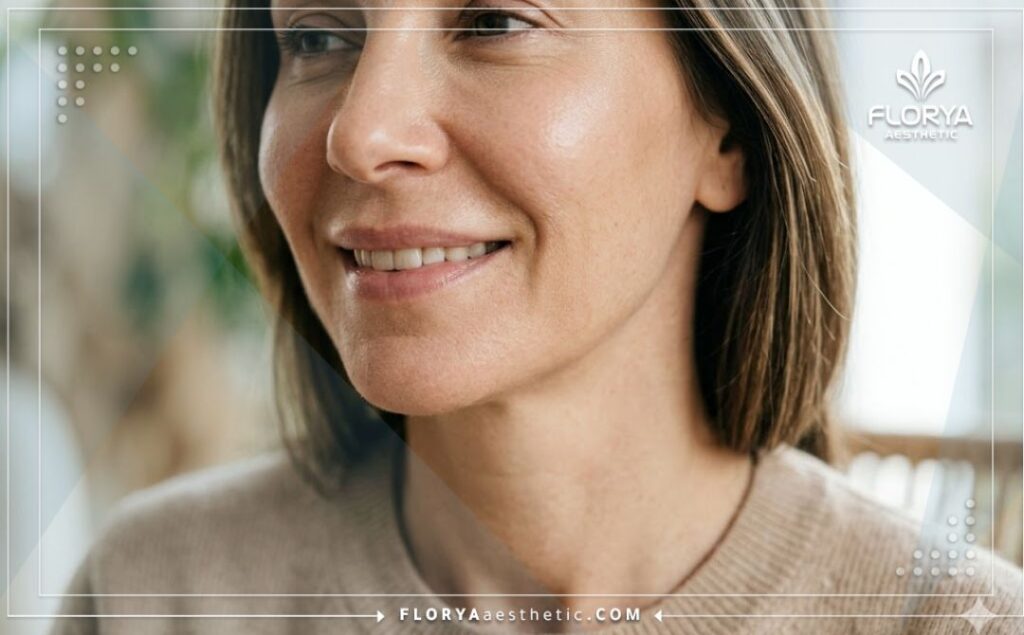 Close-up of a perfectly smoothed lower face highlighting the successful result of dermal fillers.