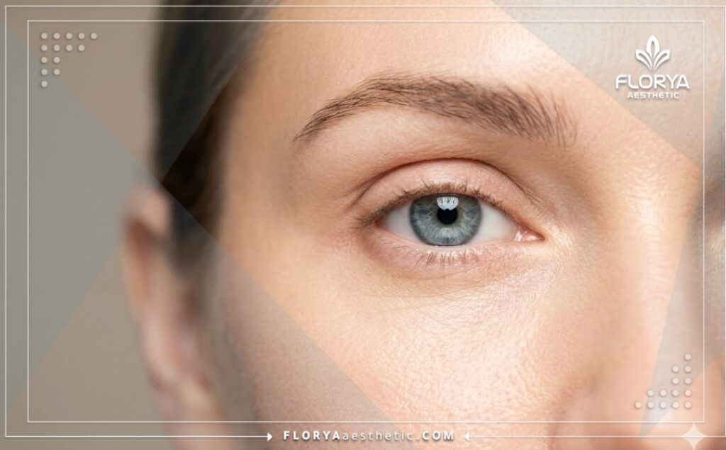 Cinematic close-up showing the flawless and youthful results of an upper eyelid lift