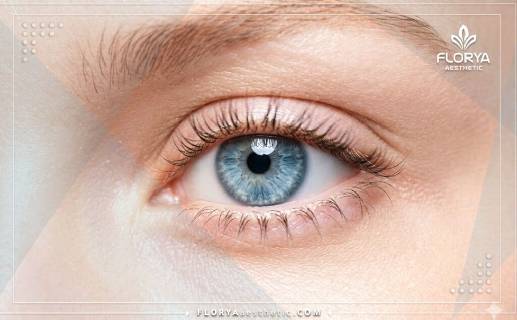Perfect, beautiful blue eye result demonstrating successful laser treatment.