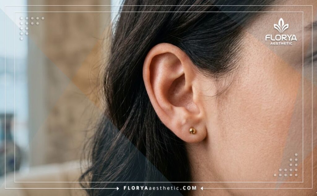 Close-up of a perfect and naturally aesthetic result of an ear correction procedure.