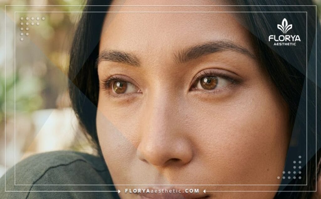 نتيجة سينمائية مثالية وجمال طبيعي بعد عملية تجميل العيون اللوزية الناجحة في اسطنبول.
